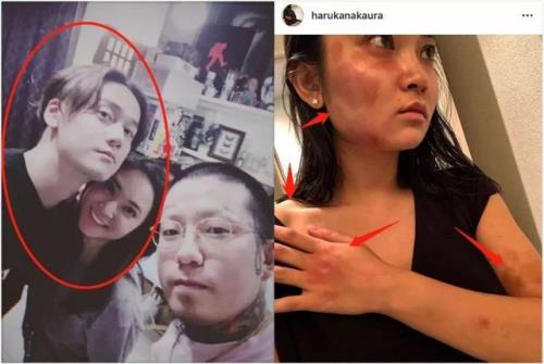 男人掐女人颈部属于家暴吗