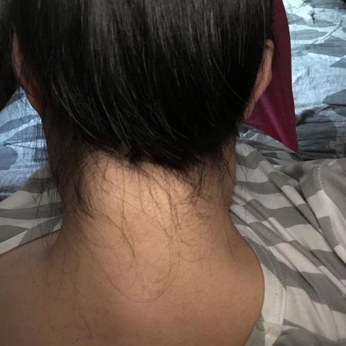 头发被自己剪坏了怎么办急