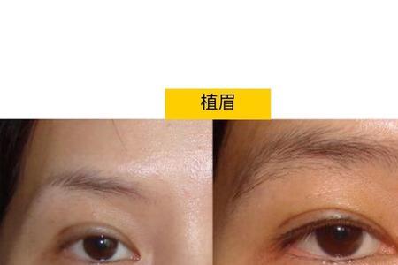 种眉和植眉的区别