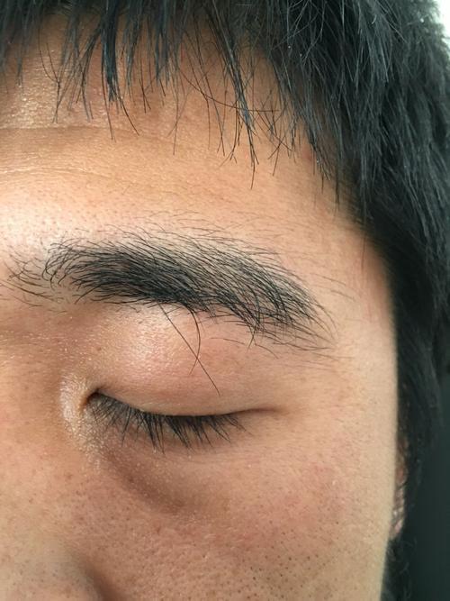 男人背后长了根常白毛什么意思