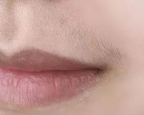 妈妈有胡子会遗传给女儿吗