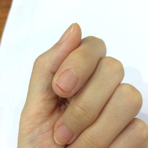 指甲剪得很秃好吗