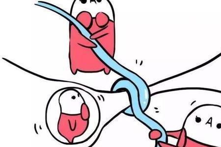 结婚后必须结扎吗