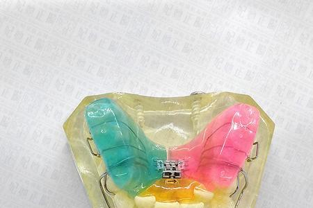 固定扩弓器怎么清洗