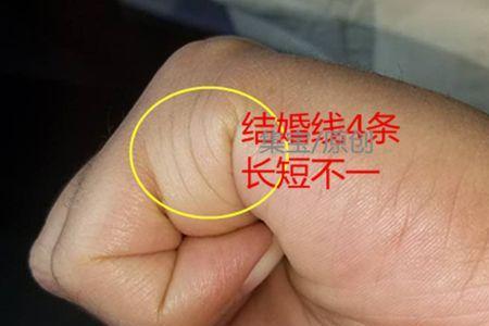 何为杂纹