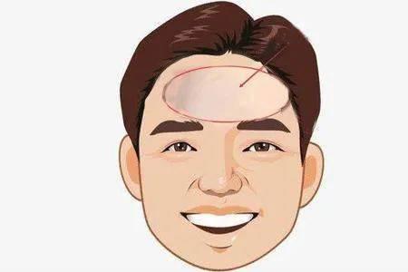 什么的额头填形容词