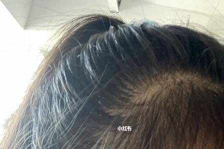 头发太硬留不了鬓角