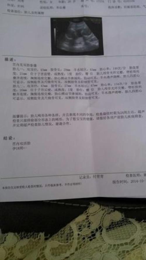 双胞胎多少斤算正常