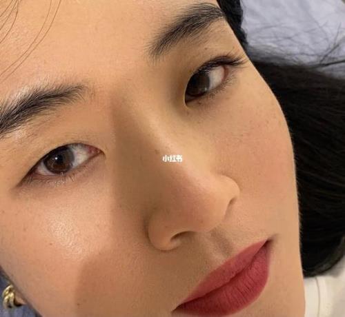 单眼皮睫毛被眼皮盖住了怎么办