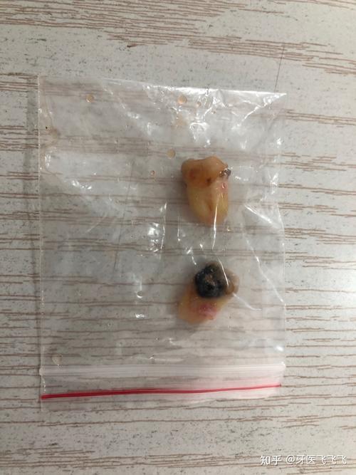 智齿是什么动物