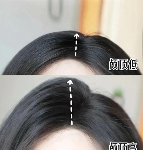 发根低怎么办