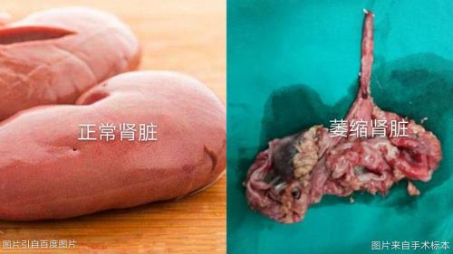 板油里面像猪肾那个是什么