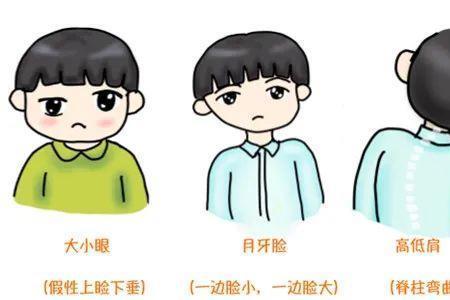 小孩两眼相距多少正常