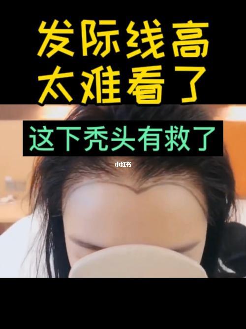 秃头还有必要去相亲吗