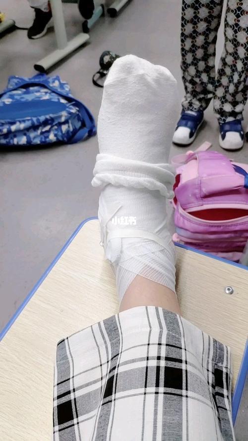 男朋友脚崴了该说什么