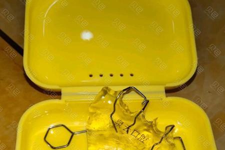 扩弓器一般戴多久