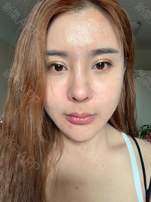 为什么后置摄像头照鼻子是歪的