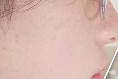 嘴巴比鼻子宽多少