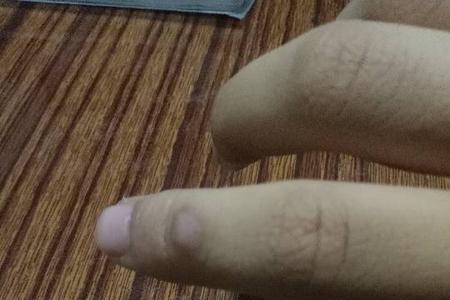 右手有疤的女生代表什么