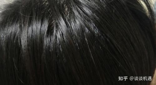 染完头发发根黏黏的很硬