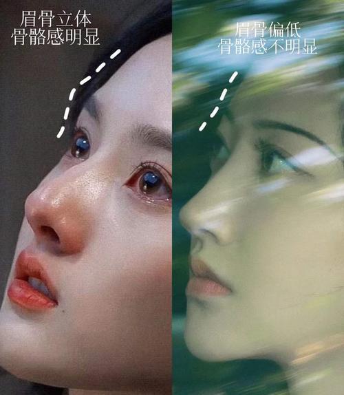 眉骨太高如何变低