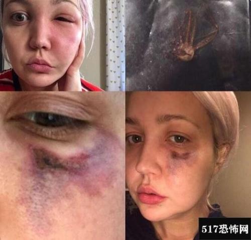 男生咬女生脸代表什么