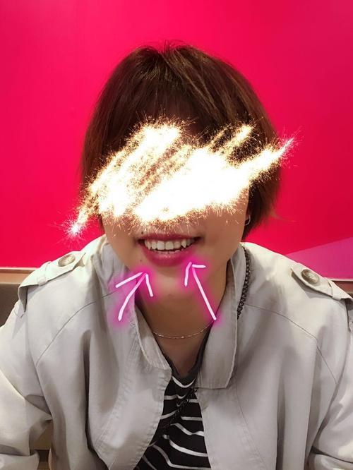 虎牙怎么变长变尖