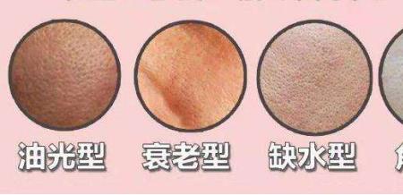 橘皮脸代表什么
