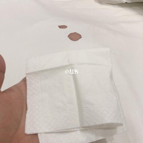 弄脏酒店的床单血渍赔多少