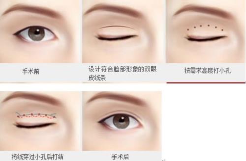 织网时怎样由大眼变小眼