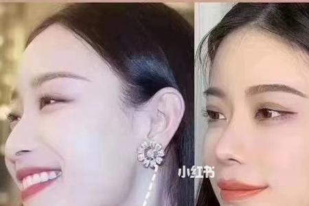 为什么有的人抬头没有下巴