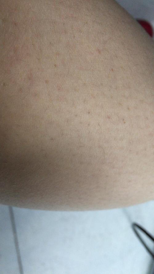大腿后面的毛叫什么毛