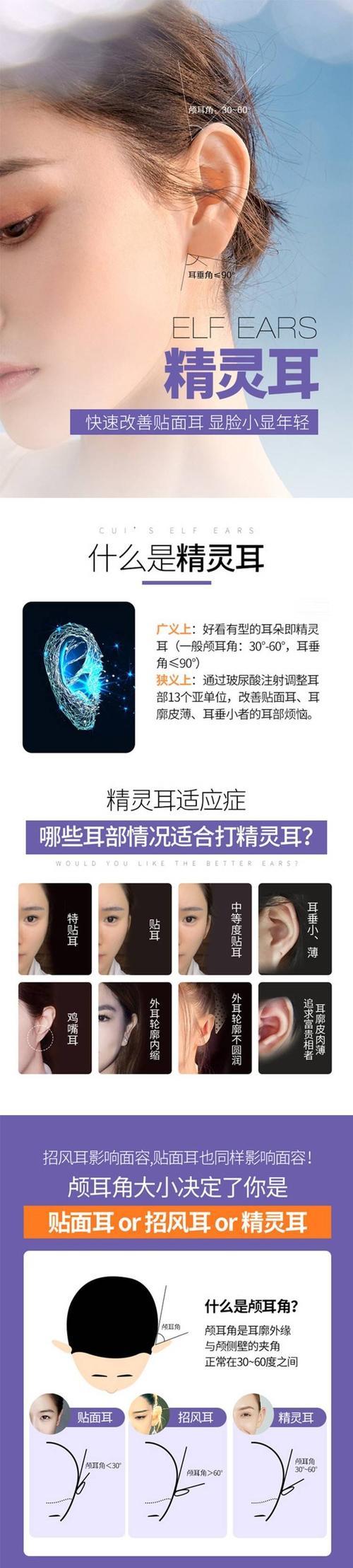 耳精灵神器用法