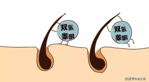 鸵鸟肉都销售哪些地方