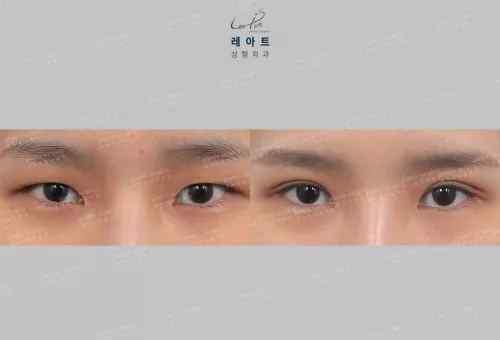 眼尾高于眼角是什么眼型