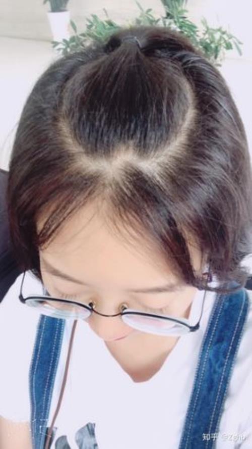 人的头发可以立起来吗