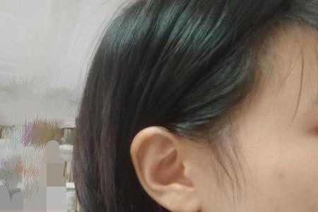 正常人嘴能张多大