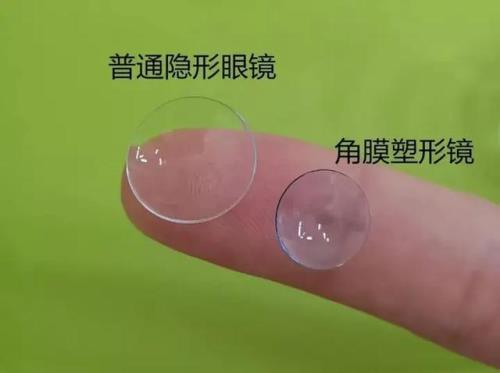 保定有ok镜吗