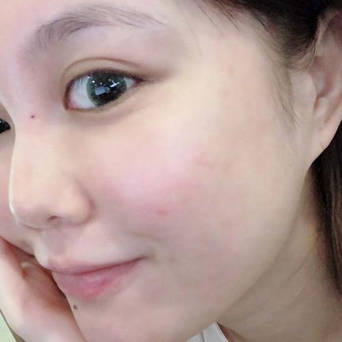 为什么小镜子照的人皮肤很差