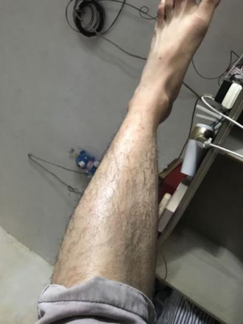 有腿毛穿什么短裤