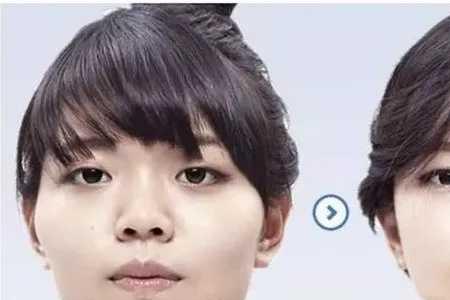 眉高颧骨低是什么样子