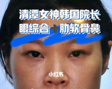 眼睛靠鼻子的角叫什么