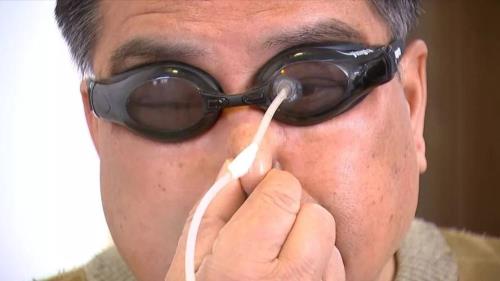 蜡烛进了眼睛里怎么办
