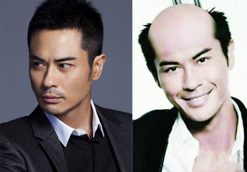 相亲男秃顶应该介意么
