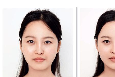 方脸钝角小是不是显得脸更小