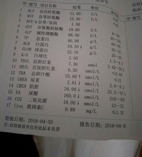 lpm是什么意思