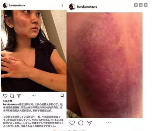 被家暴的女人都是什么性格
