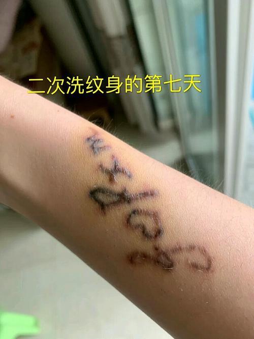 第一次洗纹身没什么变化怎么办