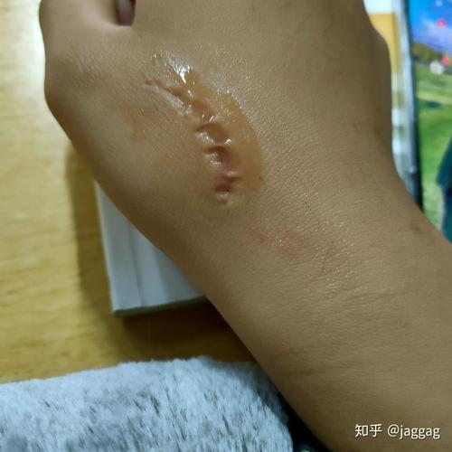 男朋友咬人是不是有暴力倾向