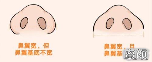 鼻弓是哪里